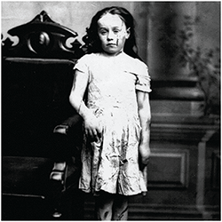 Mary Ellen Wilson